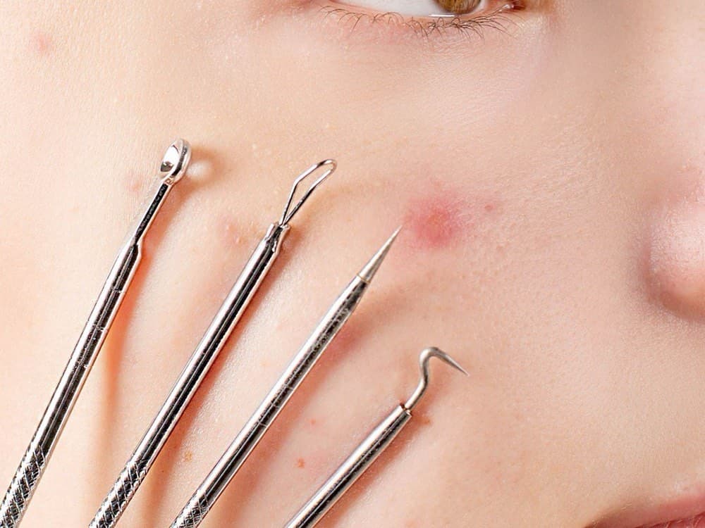 Close-up of skin being treated with fine dermatology instruments