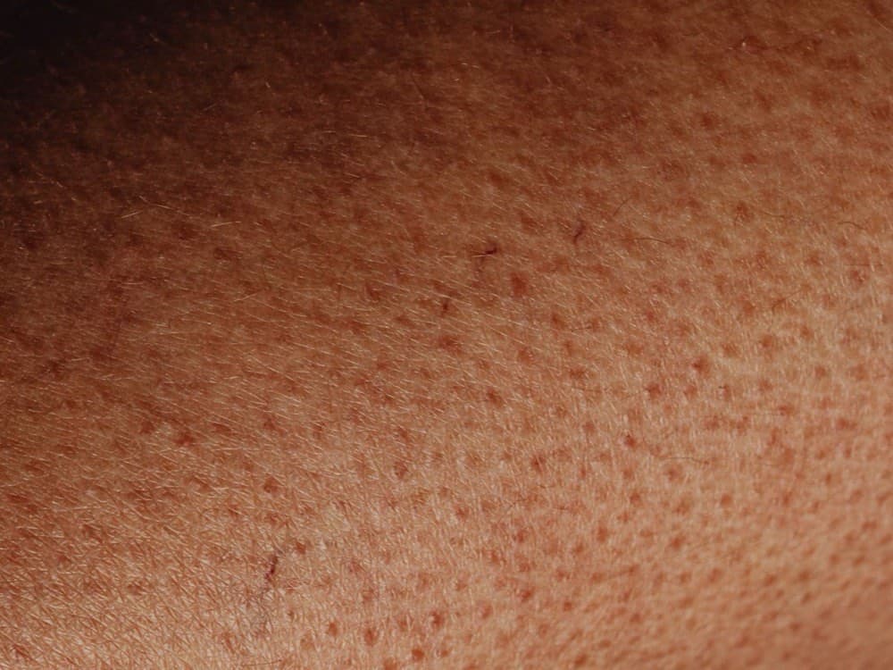 Close-up of skin showing uneven pigmentation