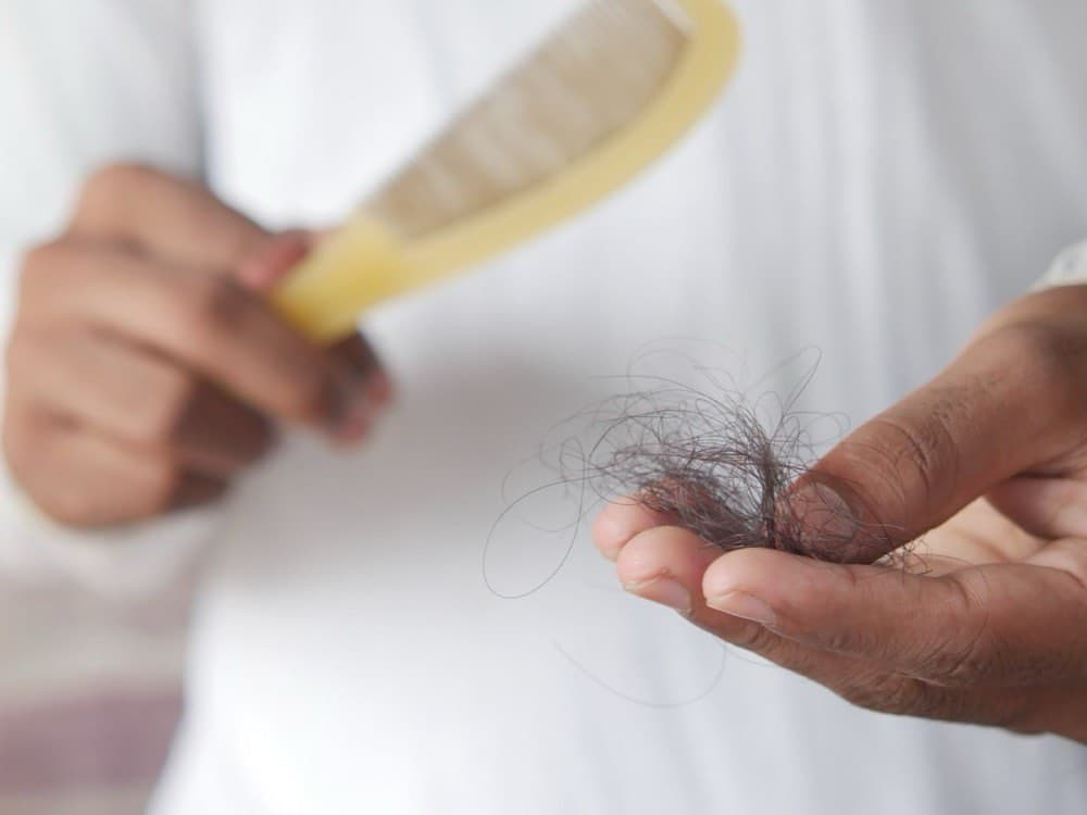 Close-up of hair strands held in the hand, illustrating hair fall